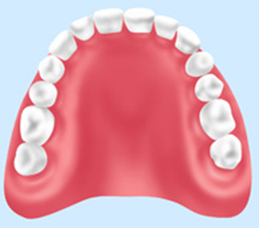 レジン床義歯
