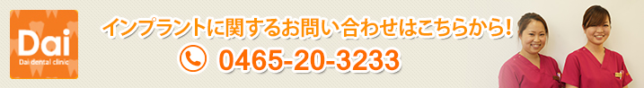 インプラントに関するお問い合わせはこちらから！